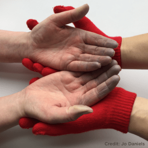 Scleroderma and Reynauds Website Post hands in gloves 300 x 300